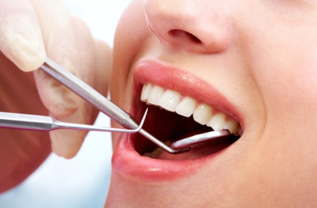 Răng khôn khi nào nên nhổ và chuẩn bị trước khi nhổ răng